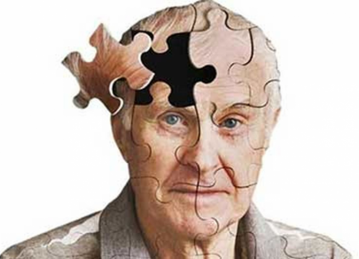 9 راه حل ساده برای پیشگیری از ابتلا به آلزایمر